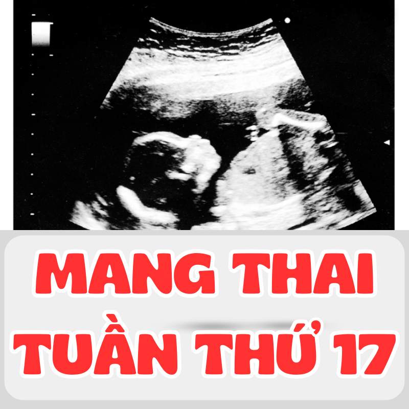 Siêu âm thai tuần thứ 17